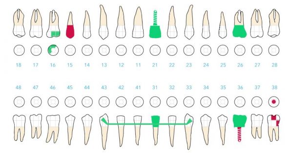 Funciones Del Odontograma Dental Imprescindibles Para Tu Clínica